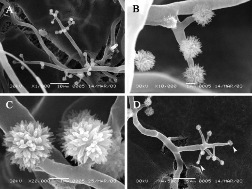 Scanning electron micrographs on the spiny balls on the shaggy ink hyphae