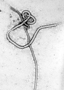 The Ebola Virus as seen under a Microscope