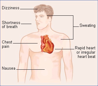 Coronary Artery Disease symptoms