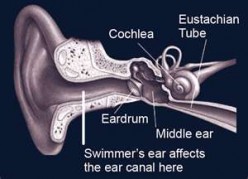 Why Swimmers Ear Hurts, and What Causes Ear Pain, Symptoms, and Treatment