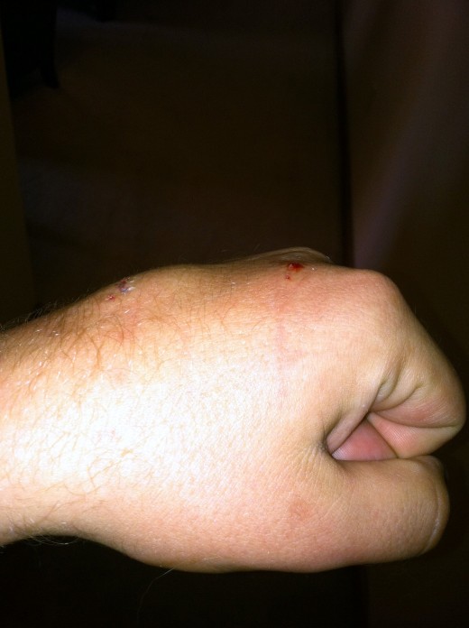 My hand got in the way of Busa's mouth this morning...numb, sore, and swollen...