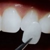 dentalimplants101 profile image