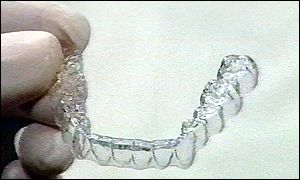 Invisible braces are worn for a few weeks, then discarded. Each time a new set is fitted by the dentist, they are modified to straighten the teeth. New braces are fitted each few weeks until the teeth are straight.