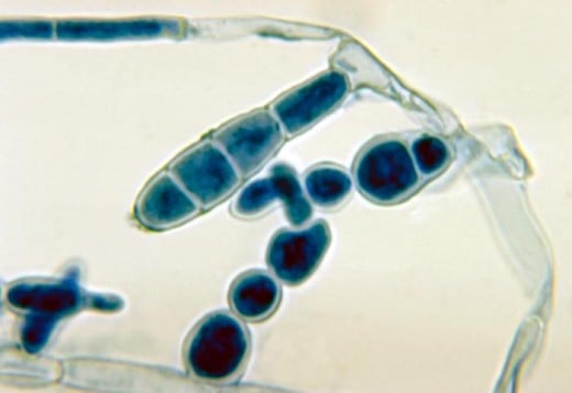 Fungus that causes ringworm