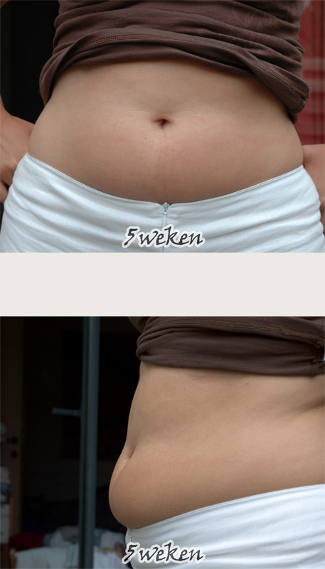 Five weeks pregnant