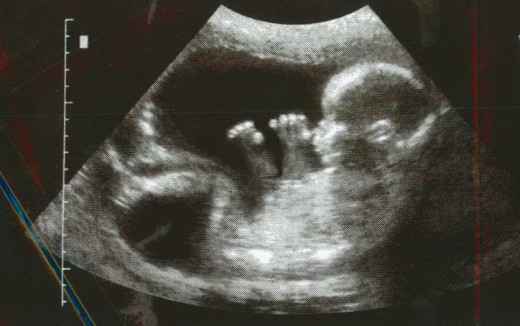 ULTRASOUND PHOTOGRAPH OF A BABY IN THE WOMB