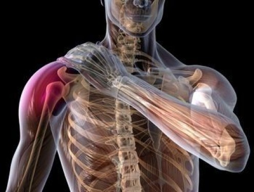 Rotator Cuff Tendinitis Exercises to Relieve Shoulder Pain Rotator Cuff Tendinitis Exercises to Relieve Shoulder Pain
