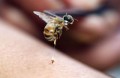 Natural Home Remedies For Insect Stings And Bites