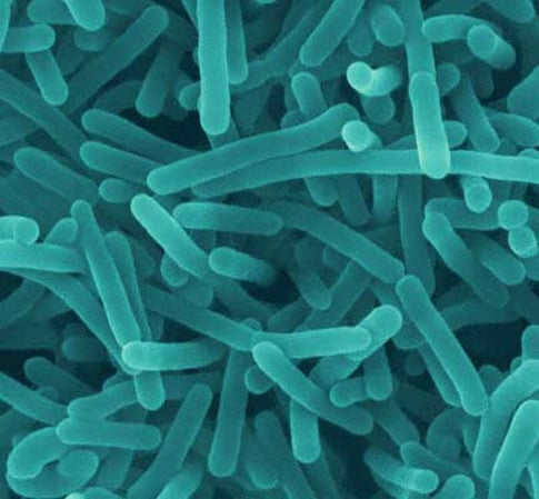 Listeria monocytogenes is a foodborne pathogen that poses serious risk to certain parts of the population. 