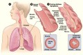 Flo-Pred-A New Asthma Medication; To Help Your Child Breathe Easier.