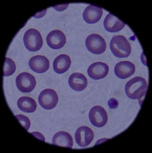 White blood cells are an integral part of the immune system.