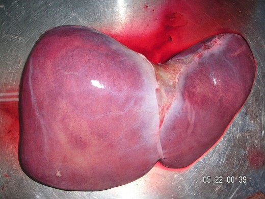 The human liver is a large organ located on the right side of the abdomen.