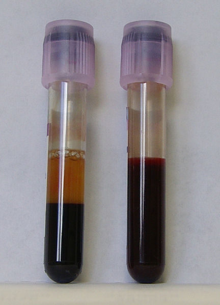 Standard blood tests can determine liver enzyme levels.