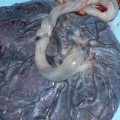 Placenta- The Third Stage of Labor