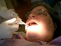 Tooth Helpers: Best Dental Hygienist Salary and Employment in the USA
