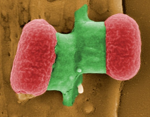 Actual microscopic photograph of the ehec bacteria