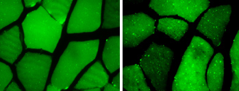 (left) Muscle cells of a resting animal. (right) Muscle cells showing little dots of GFP-LC3, the fluorescent indicator of autophagy