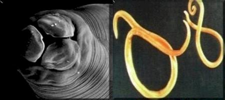 roundworm