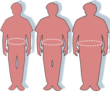 Obesity-waist circumference