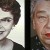 #1: Acromegalic changes in the features of the face. Most cases are discovered by comparison of old photos with the recent look. #1: Acromegalic changes in the features of the face. Most cases are discovered by comparison of old photos with the recent look.