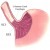 The type of cells lining the esophagus, naturally are columnar epithelium, becomes squamous epithelium, a condition called Barrett's Esophagus. The type of cells lining the esophagus, naturally are columnar epithelium, becomes squamous epithelium, a condition called Barrett's Esophagus.