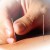 #3: Acupuncture may relieve heartburn. #3: Acupuncture may relieve heartburn.