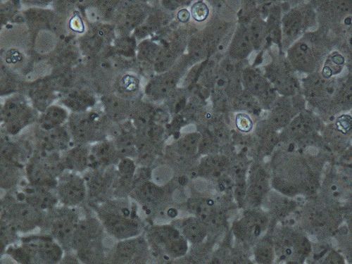 Microscopic photo of neural stem cells. Taken Summer 2011 at the Buck Institute.