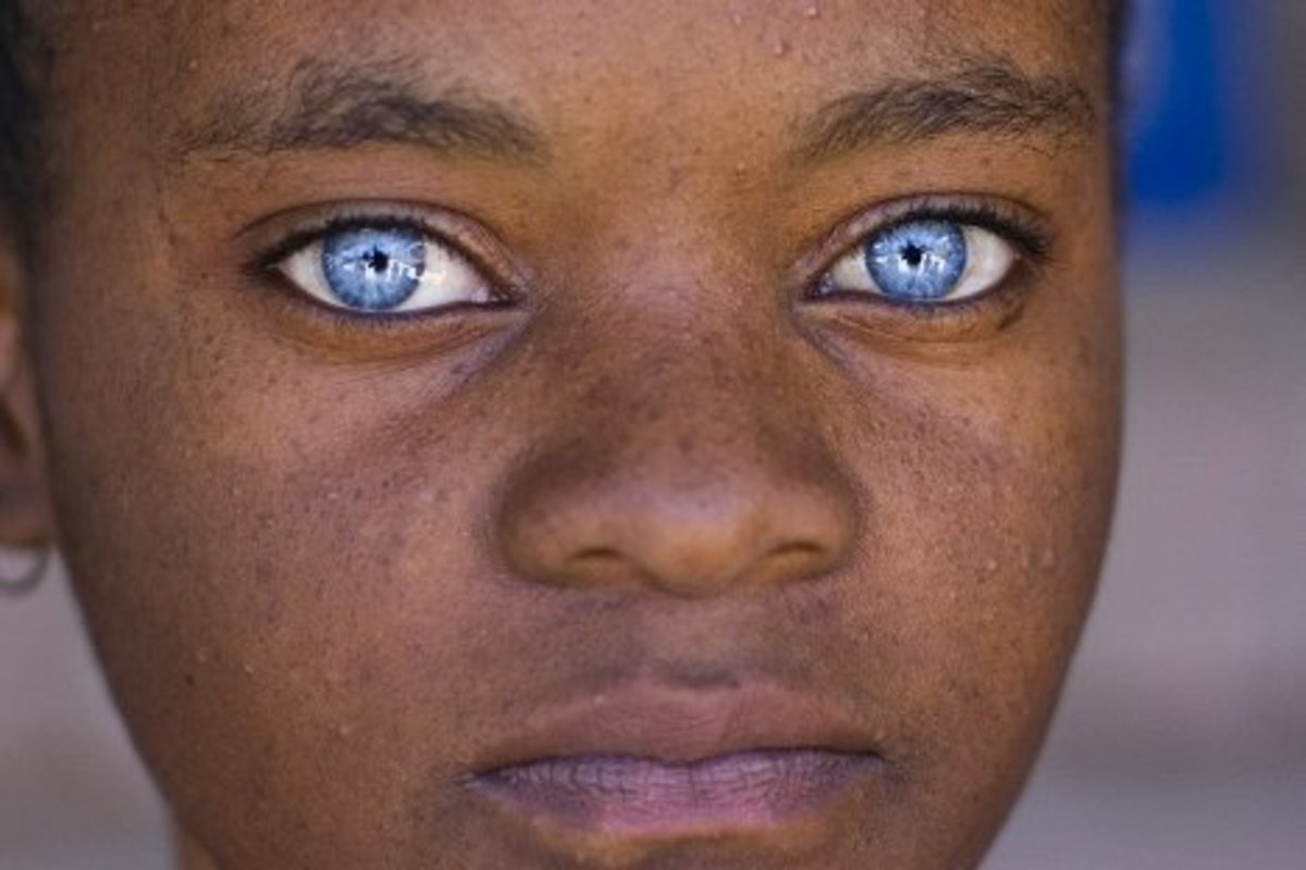 African Americans With Green Grey Hazel Or Blue Eyes Naturally