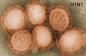 H1N1 Virus strain seen under an electron microscope