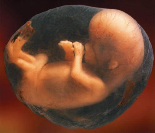 Public domain - 'a work of the United States Federal Government under the terms of Title 17, Chapter 1, Section 105 of the US Code'. See: http://en.wikipedia.org/wiki/File:Fetus_amniotic_sac.jpg