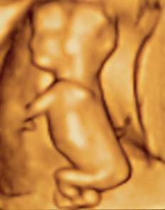 'Licensed under the Creative Commons Attribution-Share Alike 2.0 Generic license'. See: http://en.wikipedia.org/wiki/File:Ultrasound_image_of_a_fetus.jpg
