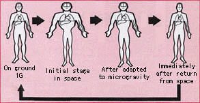 Body fluid shift through air and space travel.