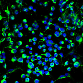A group of cultured adult neural stem cells. Blue indicates the nucleus and green represents a protein only found in immature neural cells. This photo was taken in the lab of David Schaffer at the University of California, Berkeley.