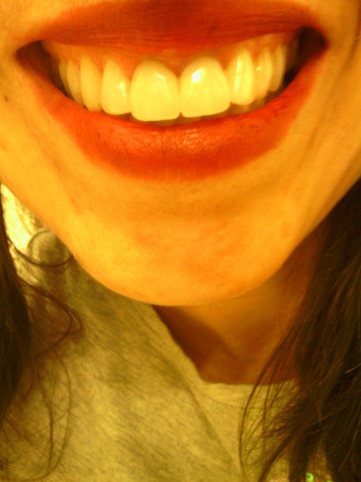 AFTER WHITENING