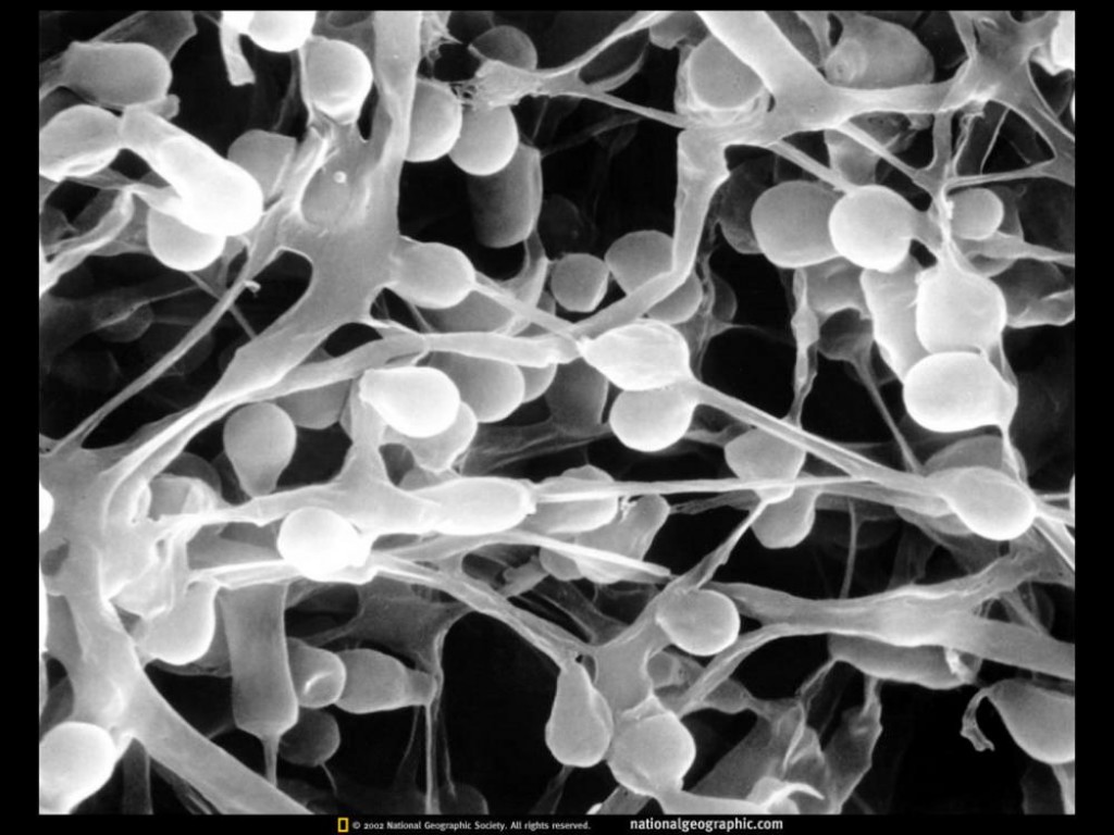 Athletes Foot (Tinea Pedis) How to treat naturally. HubPages