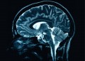 How Your Brain and Memory Works While Experiencing Trauma