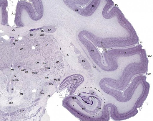 The cerebral cortex is shown here in the outer layer, in dark purple