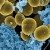 Staphylococcus aureus bacteria (gold) escaping destruction by Human white blood cells (blue) Staphylococcus aureus bacteria (gold) escaping destruction by Human white blood cells (blue)