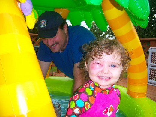 My daughter sporting her first bite to her cheekbone. We moved the pool to the deck to prevent any more attacks. 