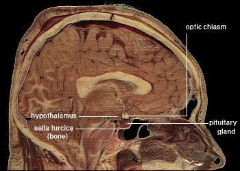 "public domain because it contains materials that originally came from the National Institutes of Health." see: http://en.wikipedia.org/wiki/File:LocationOfHypothalamus.jpg