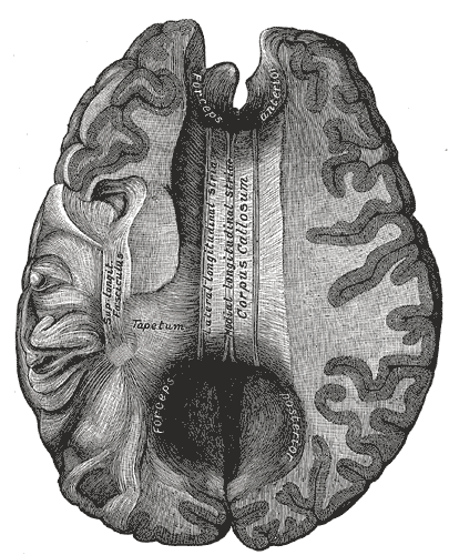 Corpus callosum (viewed from above)