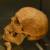 Skull of a man found buried on the site of the Roman Baths Skull of a man found buried on the site of the Roman Baths