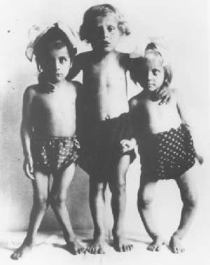 Rickets