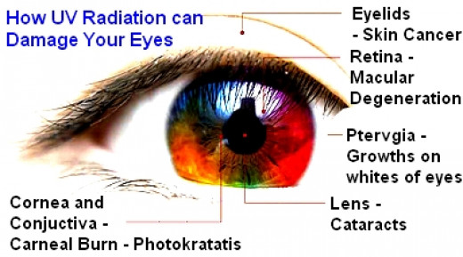 does infrared light damage eyes