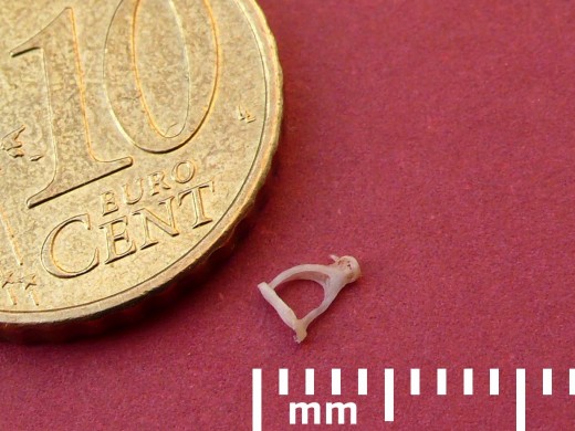 The middle ear bones are extremely small. Fixation or malformation of these bones will result in a conductive hearing loss. Here, a stapes bone is shown next to a 10 cent Euro coin.