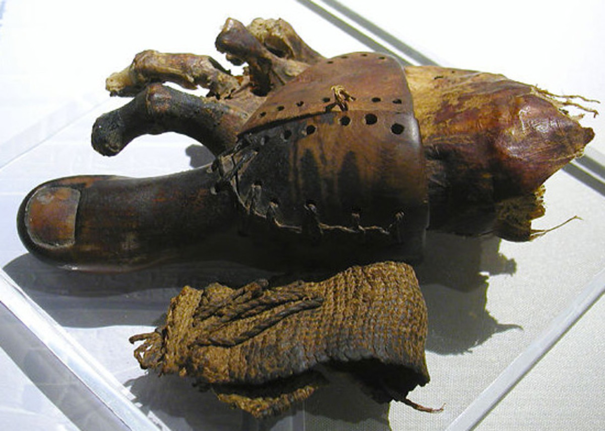 This prosthetic toe was actually uncovered at an archaeological dig in Egypt, showing that Egyptians often took extra care of their people, even giving prosthetic toes! 