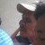 A man with skn cancer, needing a reconstructive surgery on his nose