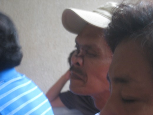 A man with skn cancer, needing a reconstructive surgery on his nose