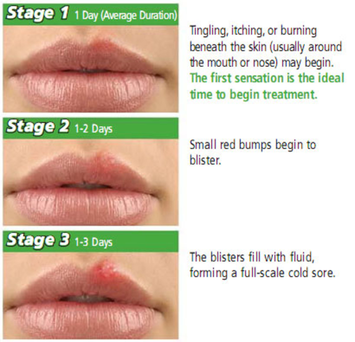 How Do I Reduce Herpes Breakouts Hubpages