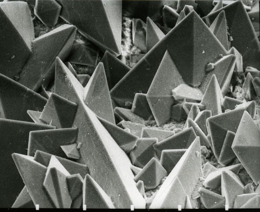 Scanning Electron Micrograph of calcium oxalate on kidney stone
